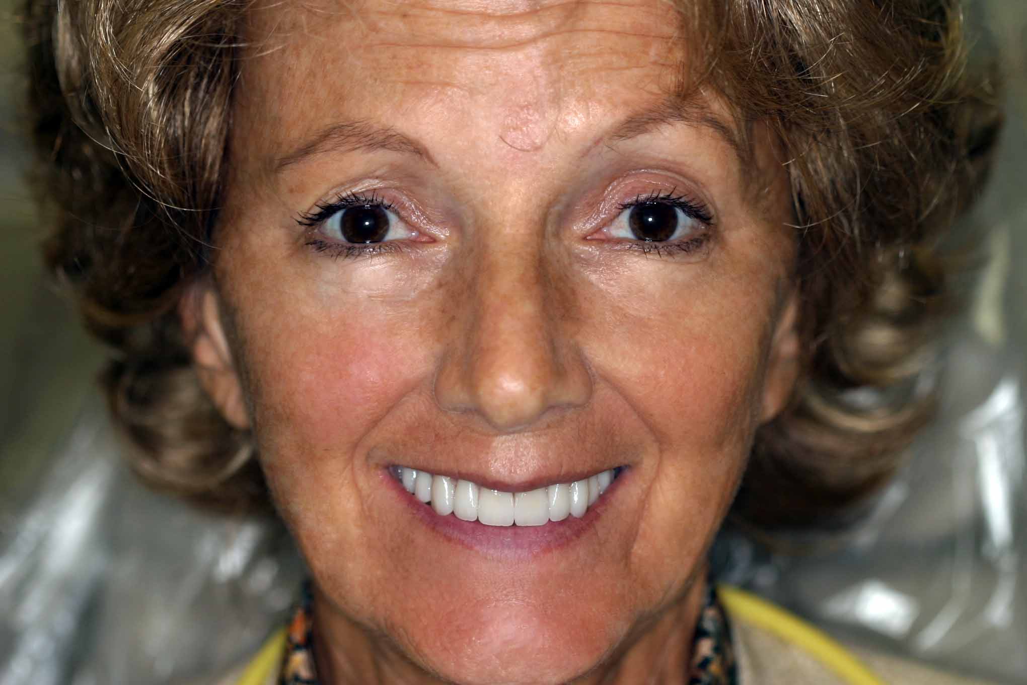 Cosmetic Dentist Fort Myers Cape Coral Naples FL